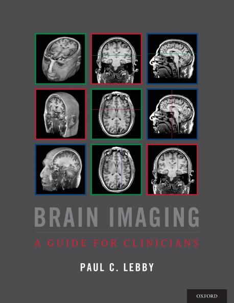 Brain Imaging