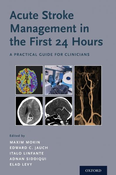 Acute Stroke Management in the First 24 Hours
