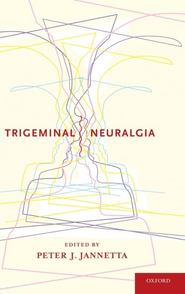 Trigeminal Neuralgia