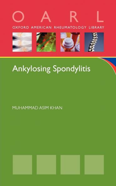 Ankylosing Spondylitis