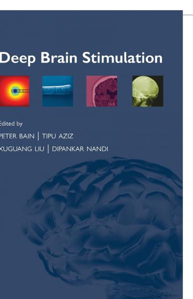 Deep Brain Stimulation