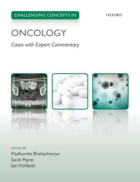 Challenging Concepts in Oncology