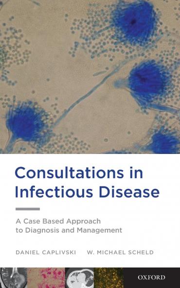 Consultations in Infectious Disease