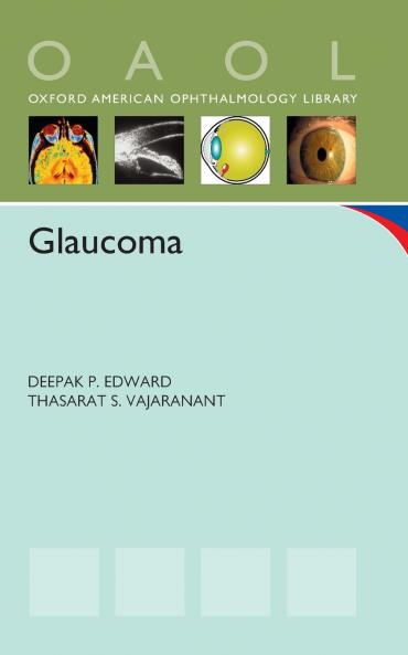 Glaucoma