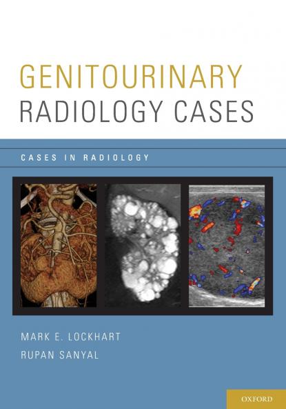 GENITOURINARY RADIOLOGY CASES CASRAD P