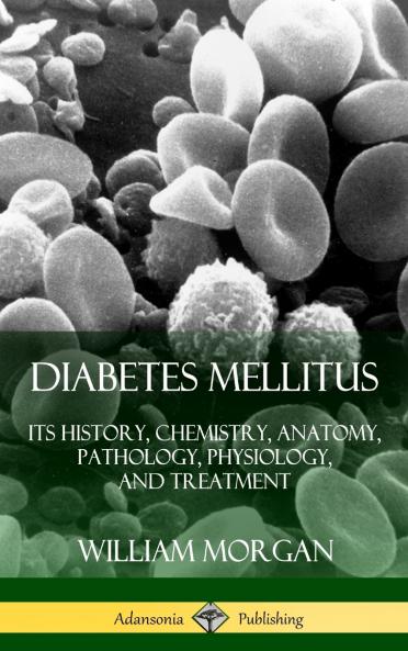 Diabetes Mellitus