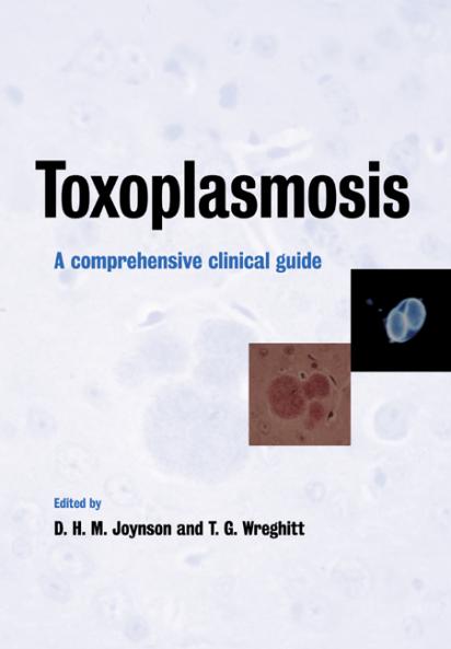 Toxoplasmosis