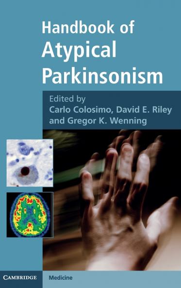 Handbook of Atypical Parkinsonism