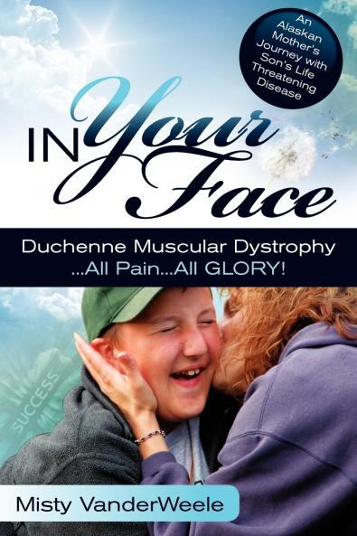 In Your Face Duchenne Muscular Dystrophy All Pain All Glory
