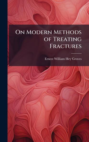 On Modern Methods of Treating Fractures