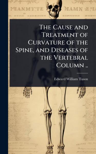 Cause and Treatment of Curvature of the Spine and Diseases of the Vertebral Column ..