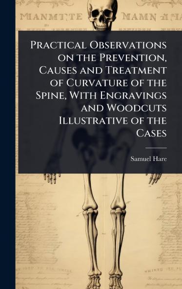 Practical Observations on the Prevention Causes and Treatment of Curvature of the Spine With Engravings and Woodcuts Illustrative of the Cases