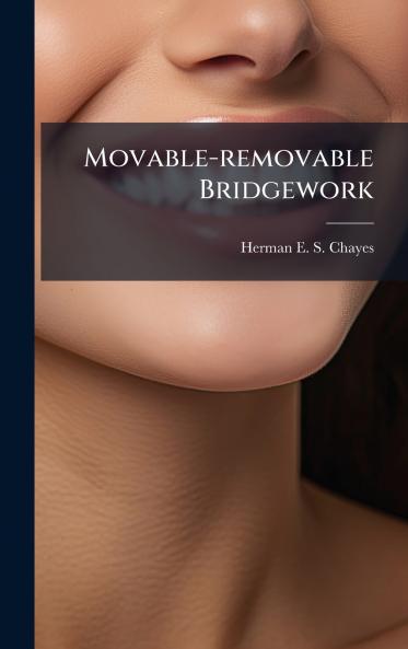Movable-removable Bridgework