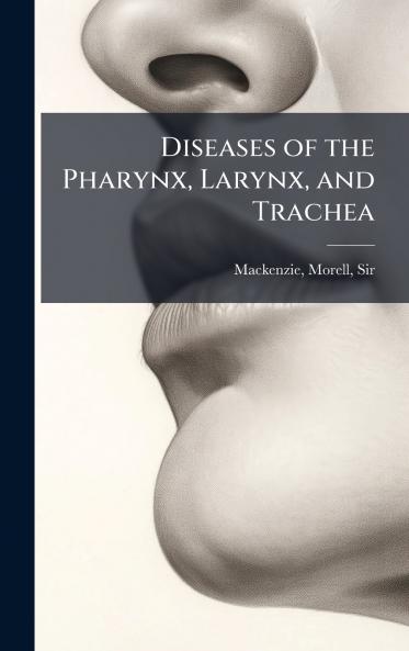 Diseases of the Pharynx Larynx and Trachea