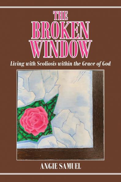 The Broken Window