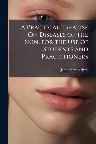 A Practical Treatise On Diseases of the Skin for the Use of Students and Practitioners