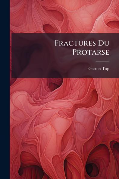 Fractures Du Protarse