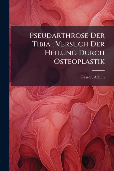 Pseudarthrose Der Tibia ; Versuch Der Heilung Durch Osteoplastik