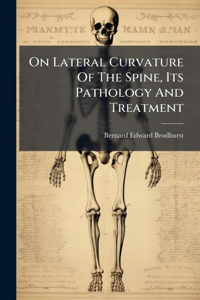 On Lateral Curvature Of The Spine Its Pathology And Treatment