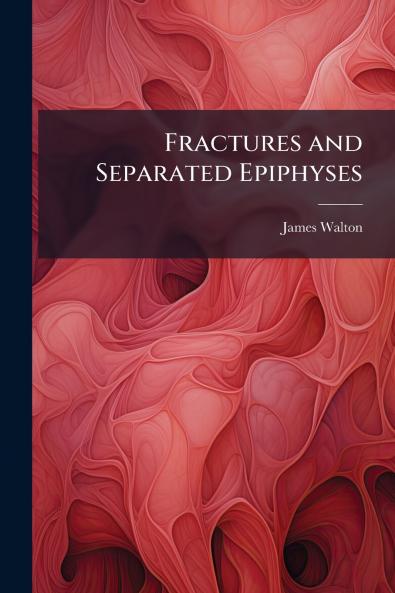 Fractures and Separated Epiphyses