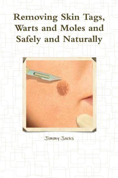 Removing Skin Tags Warts and Moles and Safely and Naturally