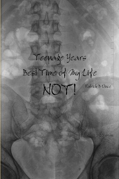 Teenage Years Best Time of My Life. NOT!