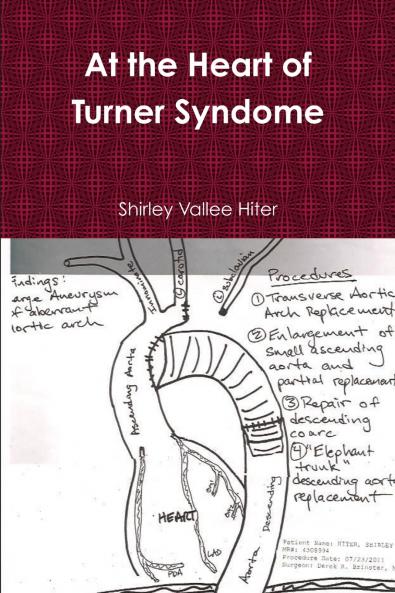 At The Heart of Turner Syndrome
