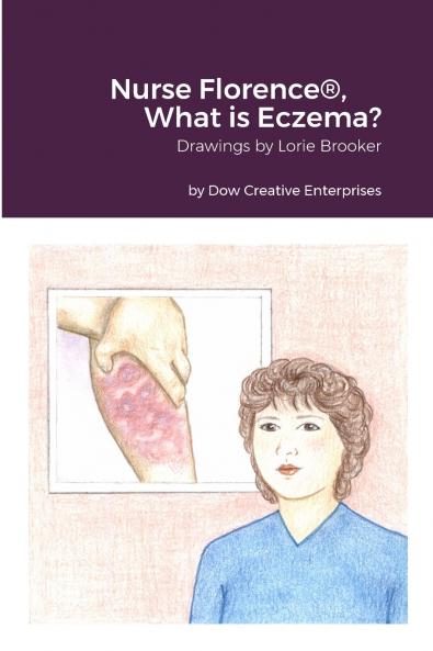 Nurse Florence® What is Eczema?
