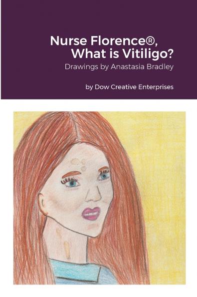 Nurse Florence® What is Vitiligo?