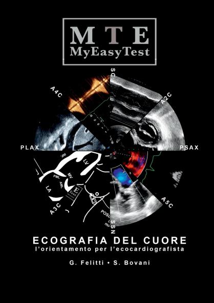 Ecografia del Cuore - MyEasyTest