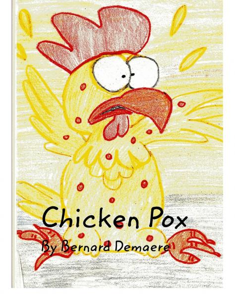 Chicken Pox