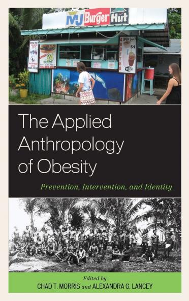 Applied Anthropology of Obesity