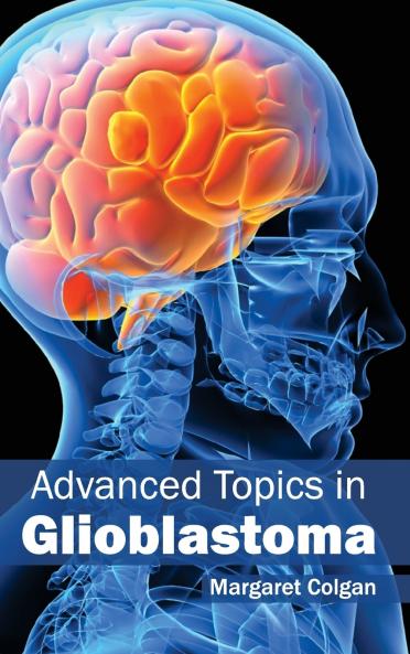 Advanced Topics in Glioblastoma
