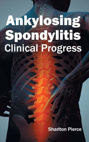 Ankylosing Spondylitis