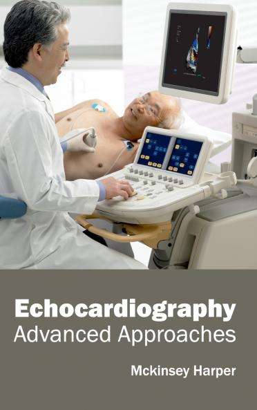 Echocardiography