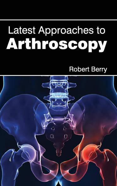 Latest Approaches to Arthroscopy