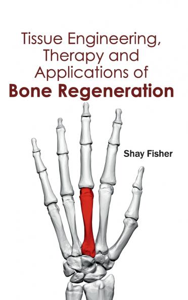 Tissue Engineering Therapy and Applications of Bone Regeneration