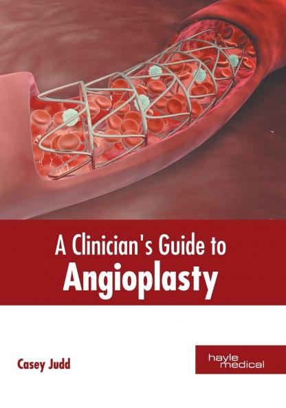 A Clinician's Guide to Angioplasty