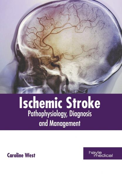 Ischemic Stroke
