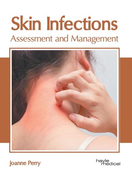 Skin Infections