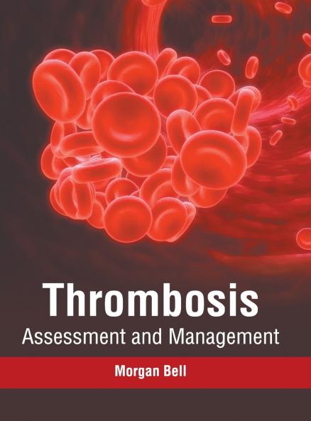 Thrombosis