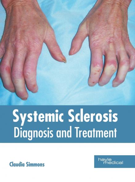 Systemic Sclerosis