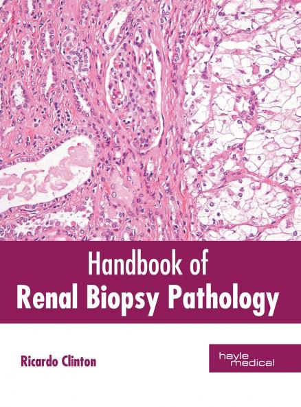 Handbook of Renal Biopsy Pathology