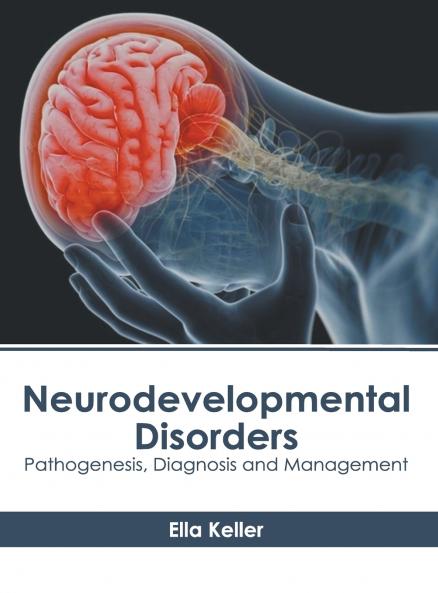Neurodevelopmental Disorders