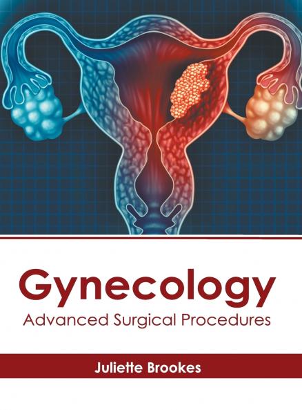 Gynecology
