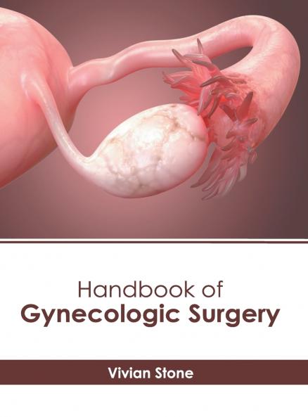 Handbook of Gynecologic Surgery