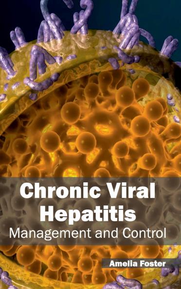 Chronic Viral Hepatitis