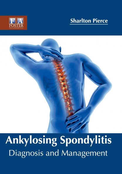 Ankylosing Spondylitis