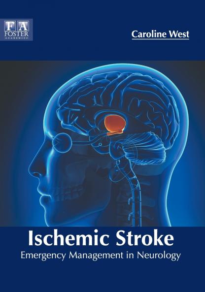 Ischemic Stroke