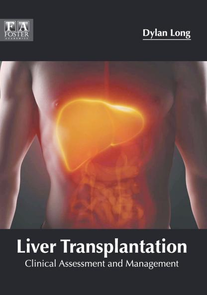 Liver Transplantation